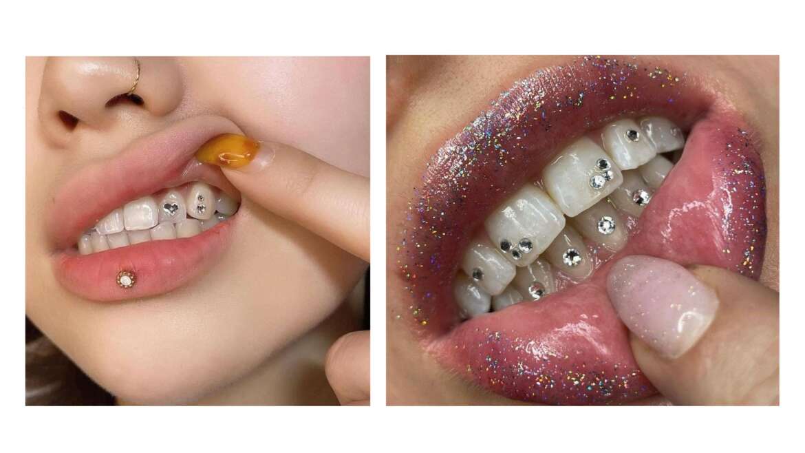 Cómo colocarte gemas dentales: 14 Pasos (con imágenes)